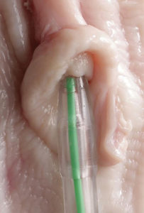 Sheep Artificial Insemination